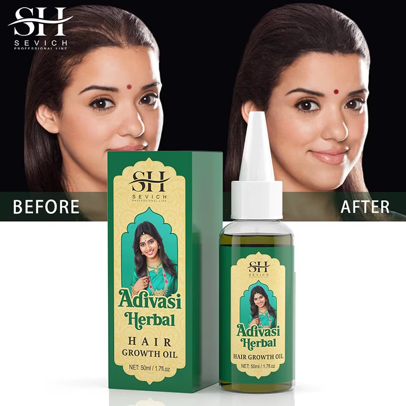 Ayurvedic Hair Growth Oil India Adivasi Organic Hair Growth Serum anti Hair Loss Fast Regrowth Thicken Oils Hair Growth Products